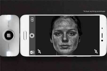 مشاهده زیر پوست با موبایل